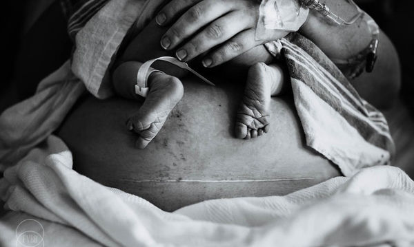 Αυτές είναι οι ωραιότερες φωτογραφίες γέννησης και τοκετού για το 2018