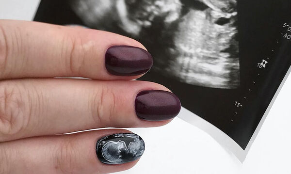 Ultrasound nails: το νέο trend ομορφιάς στις μέλλουσες μανούλες